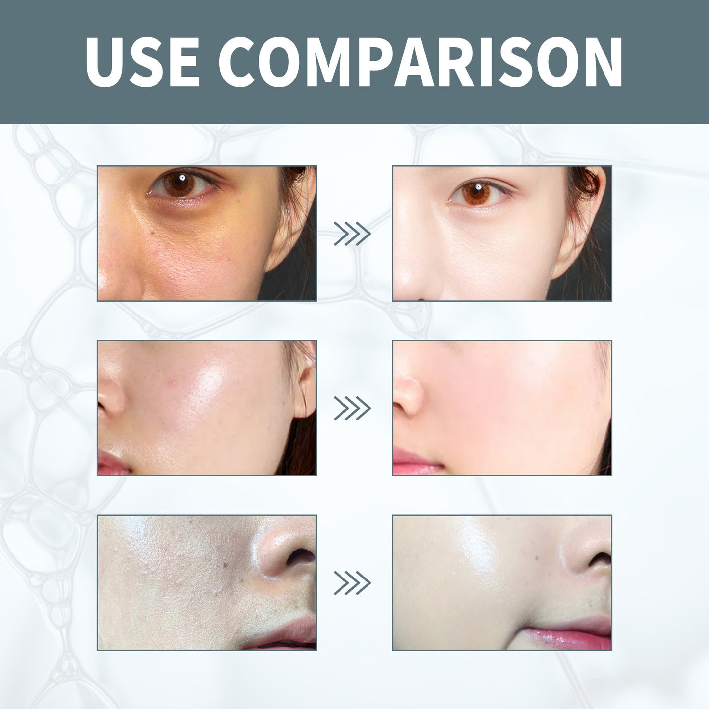 Hyaluronic Acid Serum for Deep Hydration and Skin Repair